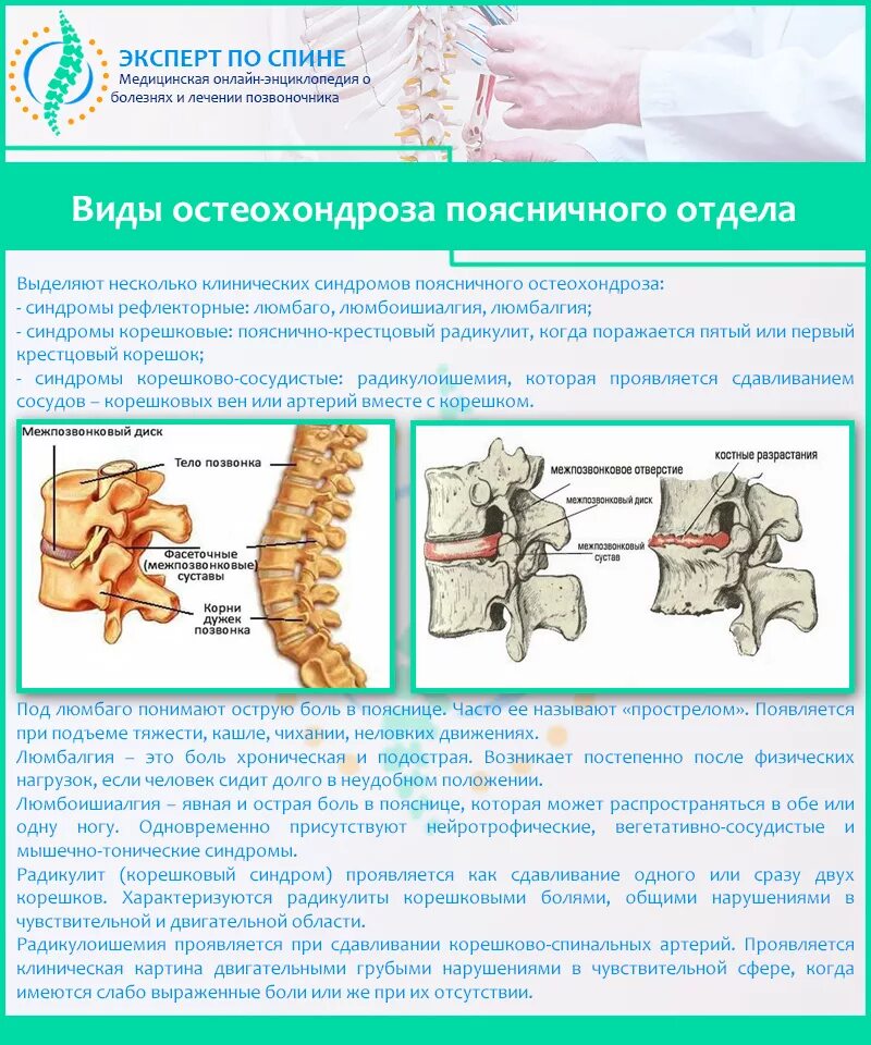 Боли при остеохондрозе поясничного отдела позвоночника. Остеохондроз 4 степени поясничного отдела симптомы. Остеохондроз пояснично-крестцового отдела позвоночника. Остеохондроз пояснично-крестцового отдела шейного и грудного отдела. Хронический хондроз поясничного отдела.