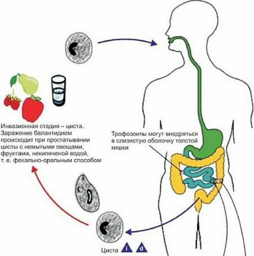 Способы заражения человека происходит. Жизненный цикл балантидия кишечного. Жизненный цикл балантидия схема. Жизненный цикл балантидия кишечного схема. Стадии жизненного цикла балантидия.