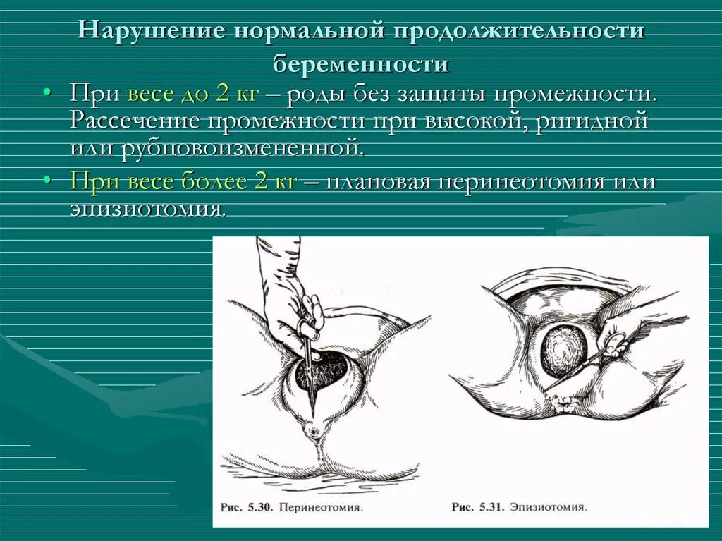 Эпизиотомия эпизиоррафия. Косметический шов кесарева скобы. Эпицистостома мочевого пузыря. Эпизиораффия. Шов хирургический внутрикожный.