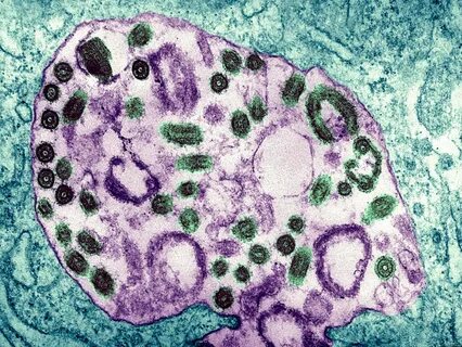 Marburg virus