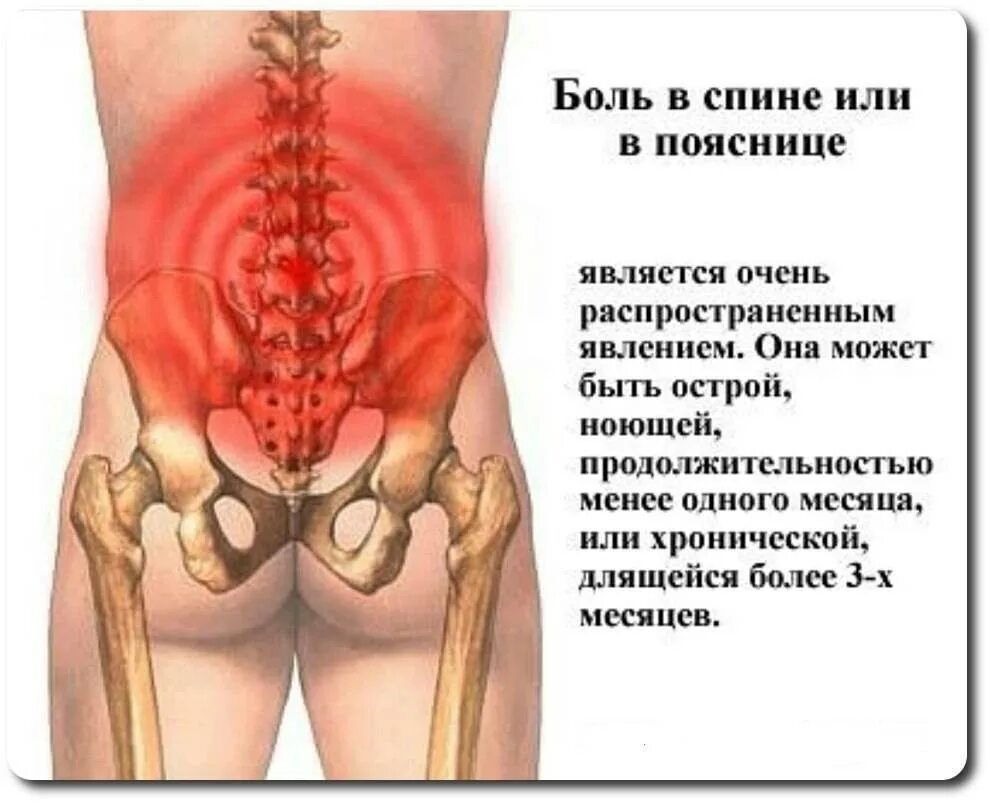 Боли в области поясницы у мужчин причины. Боль в пояснице. Боль в спине поясница. Болит в области поясницы. Болит поясница ноет.