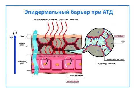 Атопический дерматит ген