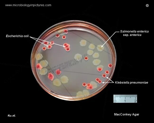 Staphylococcus e coli. Стафилококк стрептококк протей. эшерихии коли микробиология. колонии эшерихии коли. escherichia coli на среде эндо.