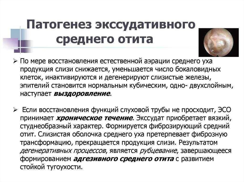 Можно пить при отите