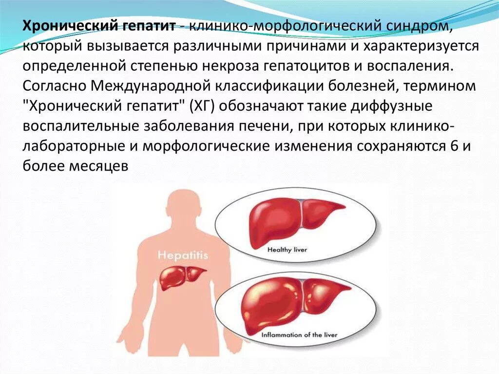 Гепатит а последствия. Хронические вирусные гепатиты синдромы. Хронический вирусный гепатит б формы. Хронический гепатит клиника. Хронический гепатит характеризуется.