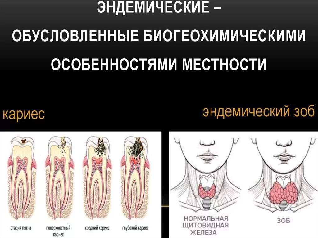 Биогеохимические эндемические заболевания. Геохимические эндемии и заболевания. Биогеохимические эндемии виды. Эндемичные заболевания примеры.