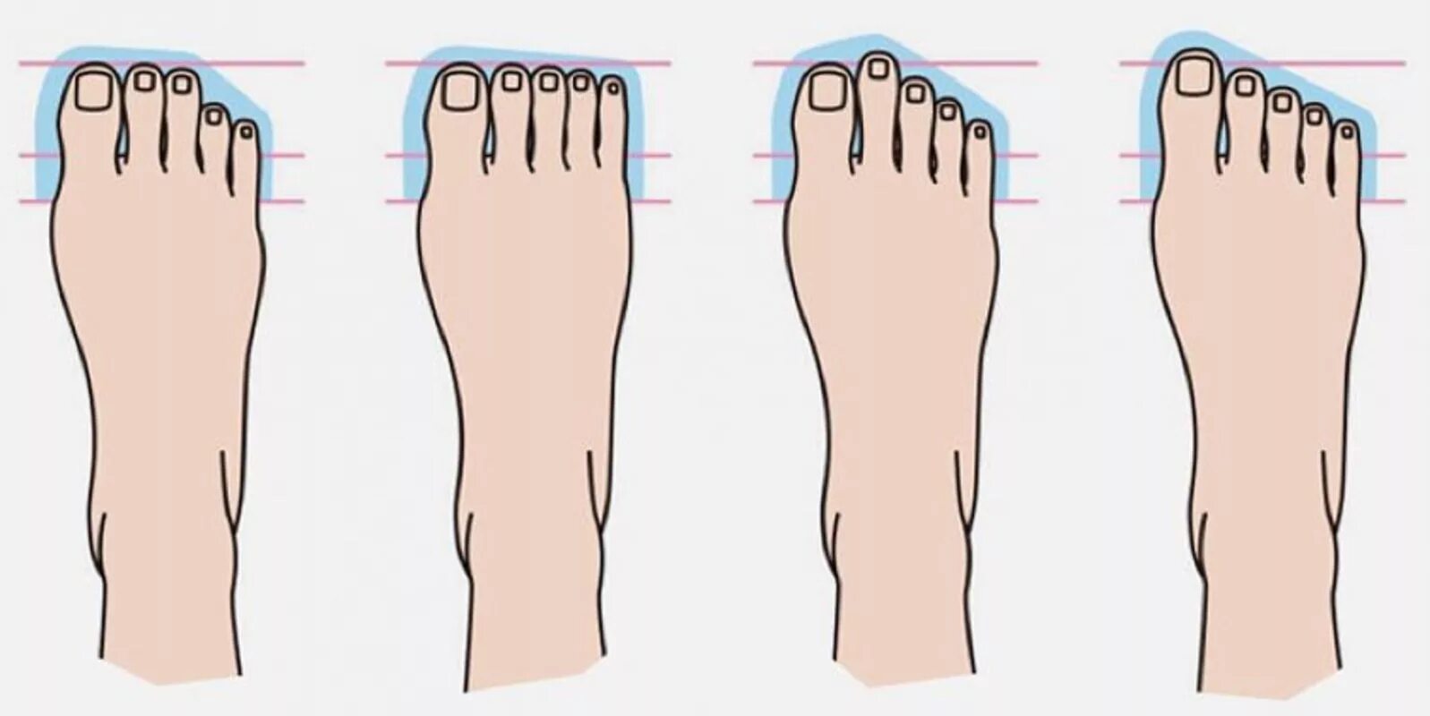 Ступни виктории полторак. Стройные и ровные ноги. Ложная х образная кривизна ног. Вальгусная и варусная стопа. Виктория полторак feet.