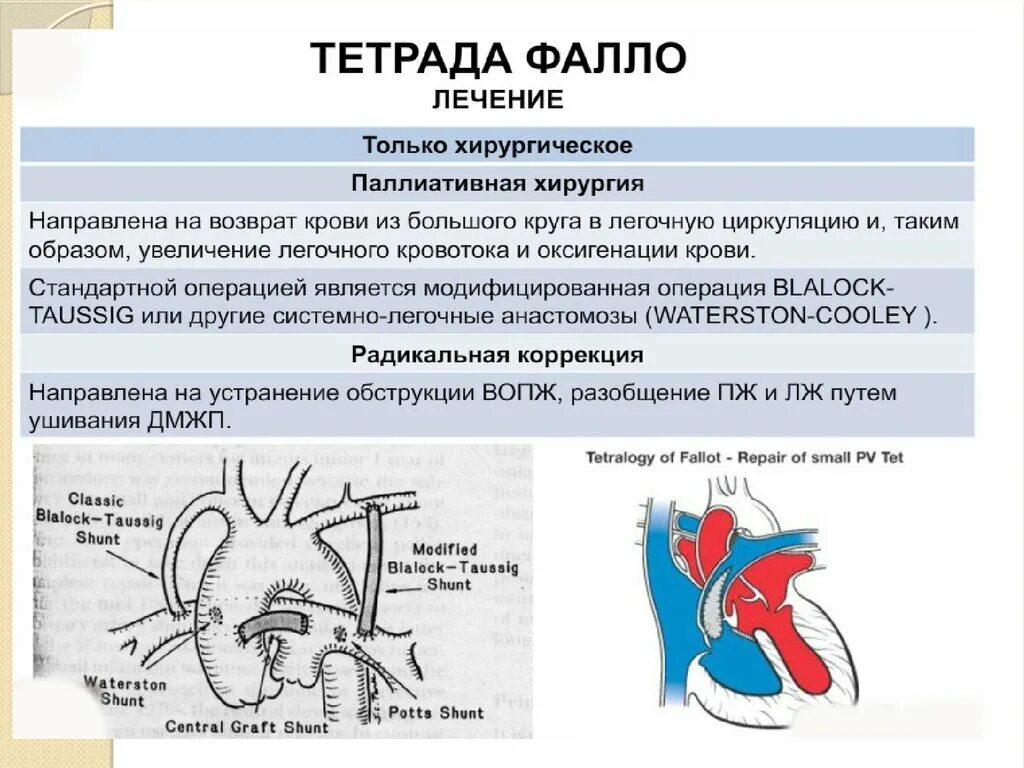 Дефект аортолегочной перегородки тест нмо