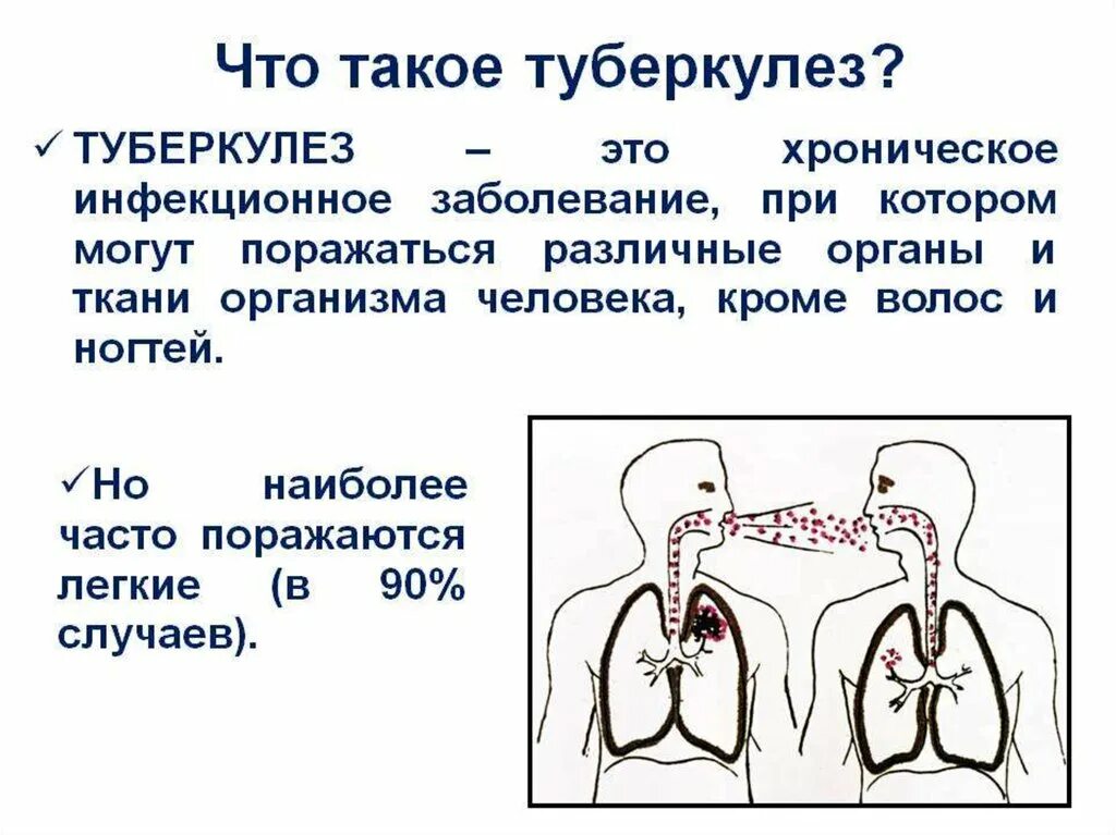 Туберкулез это инфекционное заболевание. Открытые формы туберкулеза. Лечение легкого ковида