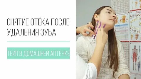 Как убрать отеки после родов