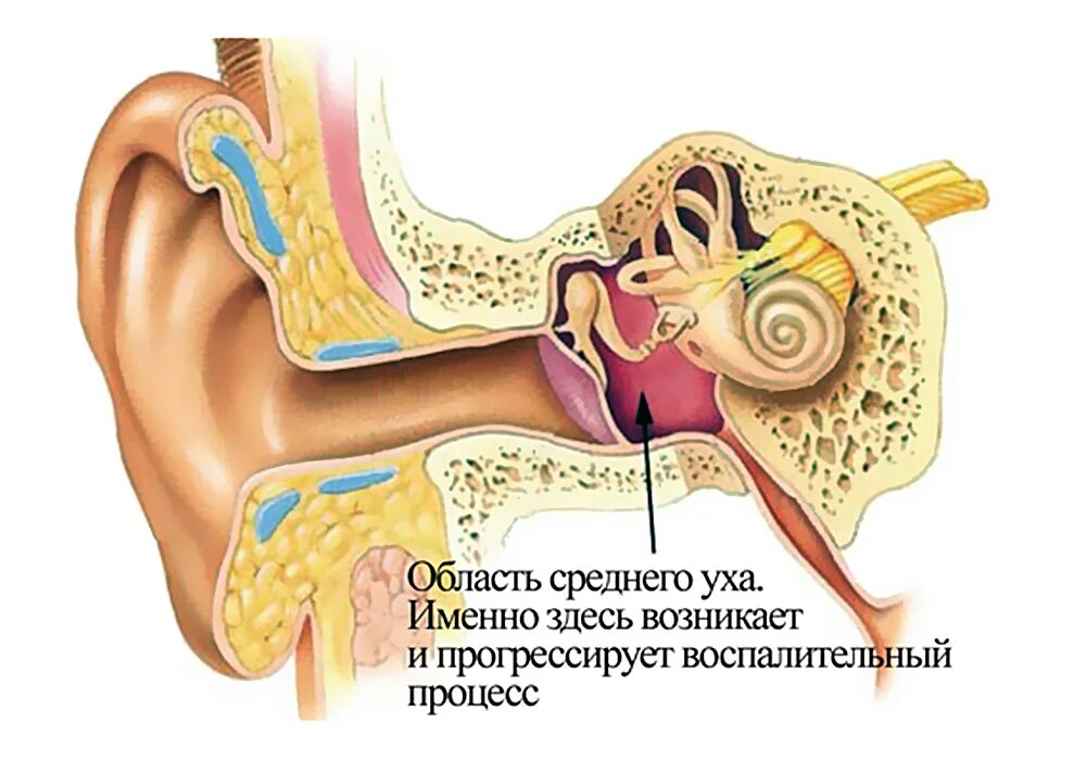 Наружный отит хронический средний отит. Гнойный отит мастоидит. Адгезивныйсрдений отит.