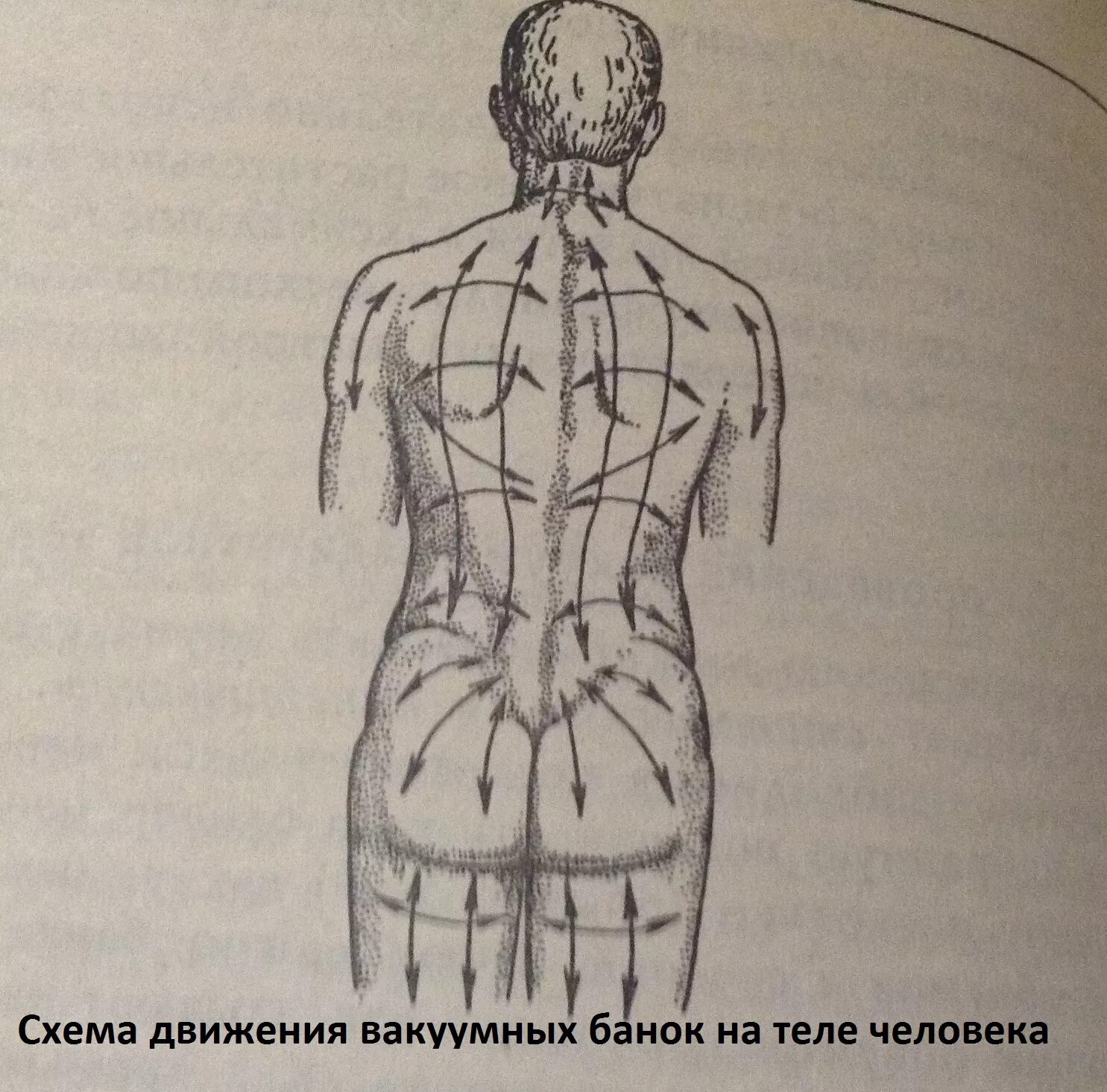 Массажные линии для вакуумного массажа банками. Массажные линии тела. Линии баночного массажа спины. Массажные линии для вакуумного