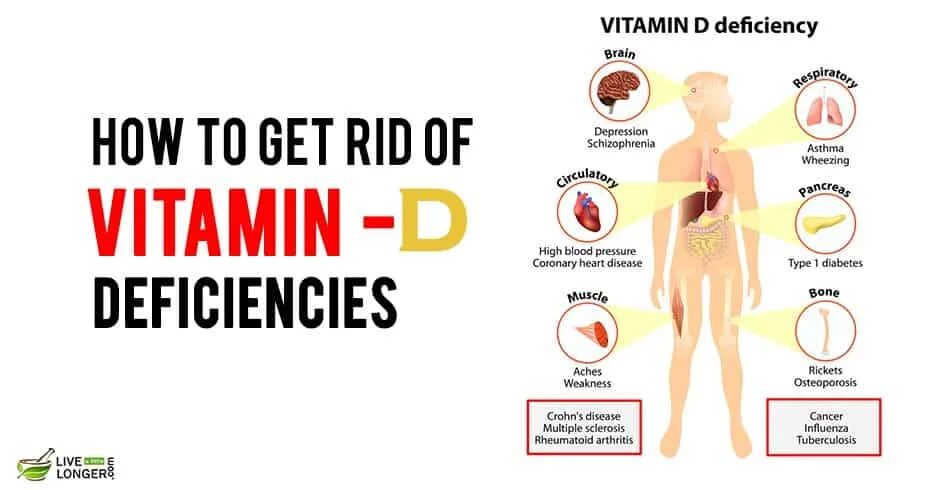 Vitamin deficiency