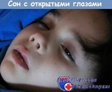 Почему спят с закрытыми глазами