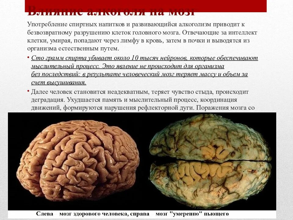 И т д последствия в. Мозг человека алкоголика. Мозг человека и мозг алкоголика.