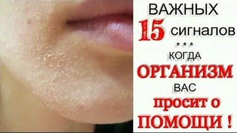 Облезают руки каких витаминов не хватает