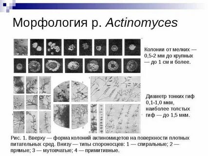 Таксономия актиномицетов