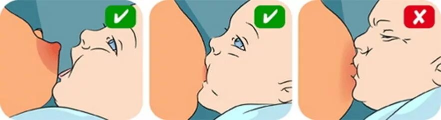 Срыгивает через нос и рот. Правильное прикладывание при грудном вскармливании новорожденного. Правильный захват груди. Правильное прикладывание ребенка к груди. Техника прикладывания ребенка к груди.