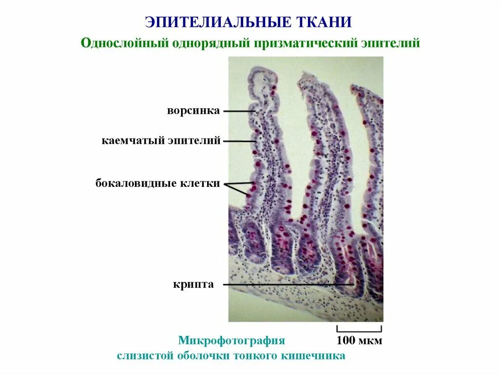 Ткани тонкой кишки. Ворсинки тонкой кишки гистология. Бокаловидные клетки эпителия кишечника. Однослойный каемчатый однорядный кишечный эпителий. Столбчатый каемчатый эпителий.