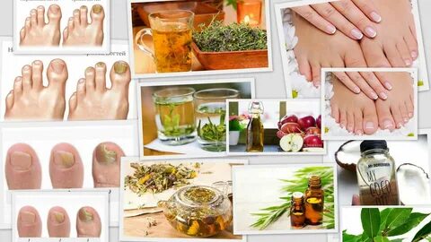 Грибок народный метод