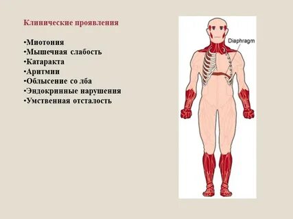 Дистрофия клинические проявления