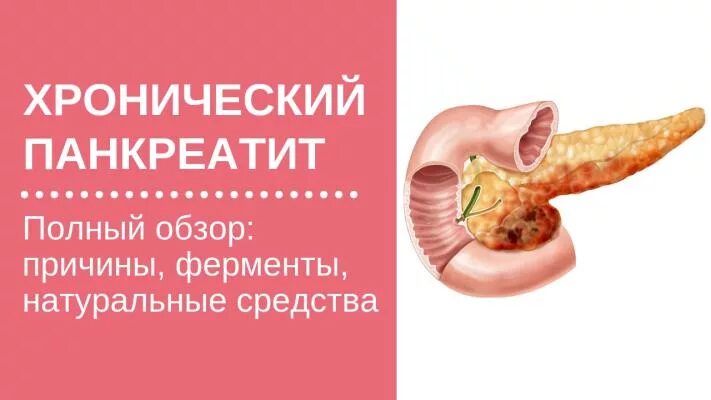 Острый панкреатит патологическая анатомия. Хронический панкреатит заболеваемость по возрастам. Стул характерный для панкреатита. Что такое панкреатит поджелудочной. Хронический кальцифицирующий панкреатит кт.