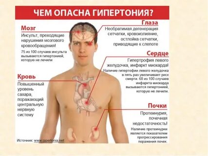 Прогрессирующая гипертония