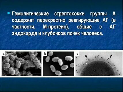 Бета гемолитический стрептококк группы b
