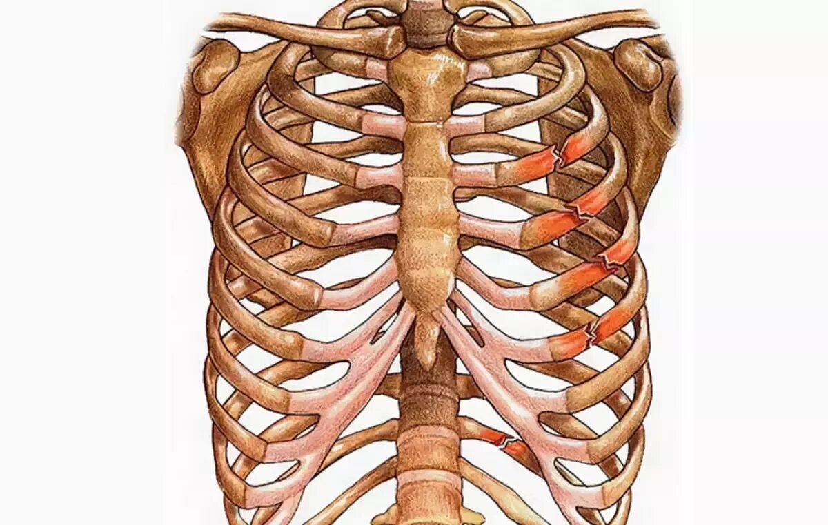10. Грудная клетка (ребра, Грудина)..