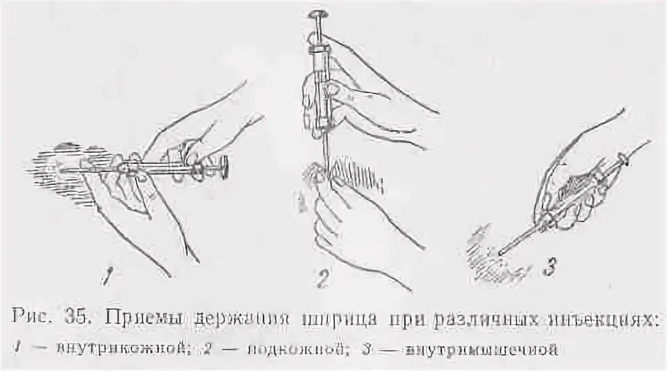 Как правильно держать шприц. Техника введения внутримышечных инъекции у КРС. Внутримышечный укол собаке схема. Введение иглы при внутрикожной инъекции.