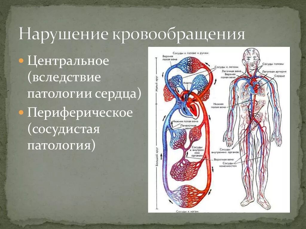 Периферическая система кровообращения схема. Нарушение кровообращения. Патология кровообращения. Нарушение системы кровообращения. Нарушение общего кровообращения