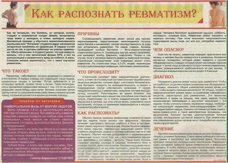 Ревматизм суставов симптомы у женщин после 50