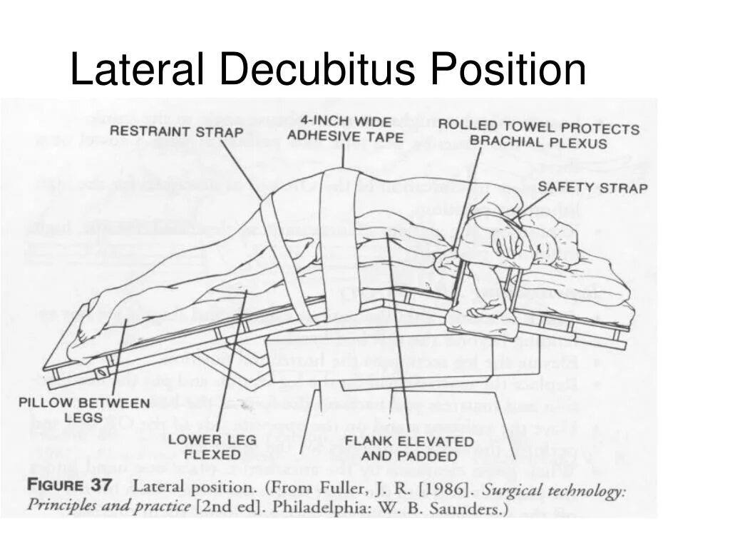 Ending position. Lateral position.