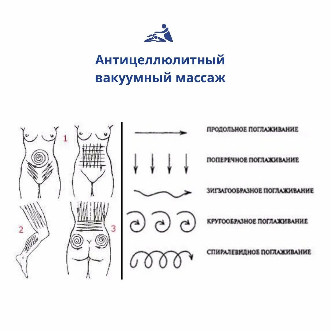 Лимфодренажный инструкция. Схема антицеллюлитного массажа вакуумными банками. Вакуумный баночный массаж спины схемы. Антицеллюлитный массаж банками вакуумными схема. Схема баночного антицеллюлитного массажа.