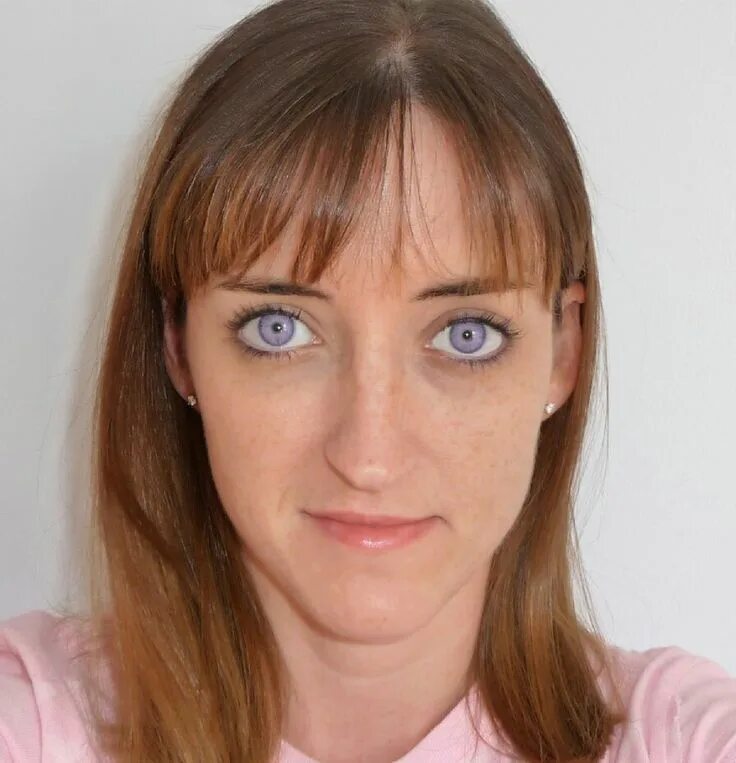 Дистихиаз у элизабет тейлор. Генезис александрии фиолетовые глаза. Фиолетовые глаза. Синдром александрии глаза. Реальные фиолетовые глаза.