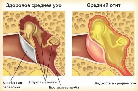 Болит за ушами с двух сторон