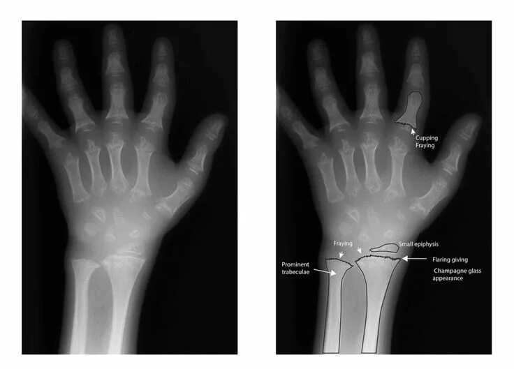 Source x rays