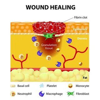 Wound healing