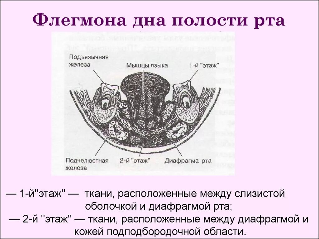 Пространства полости рта. Флегмона дна ротовой полости. Клетчаточное пространство дна ротовой полости. Флегмона дна полости топографическая анатомия. Клетчаточные пространства дна полости рта топографическая анатомия.