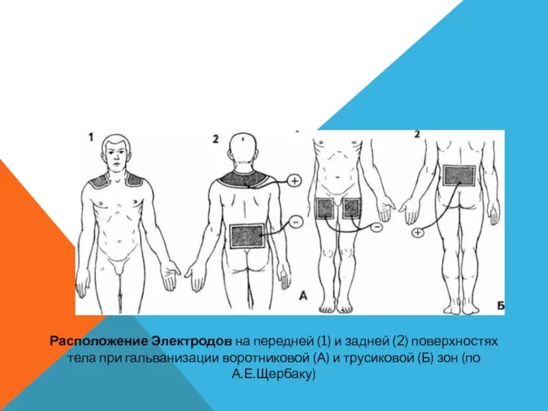 Массаж воротниковой зоны схема. Имаз по кузнецову при бронхиальной астме. Гальванизация воротниковой зоны по щербаку. Гальванизация расположение электродов. Прием выжимание.