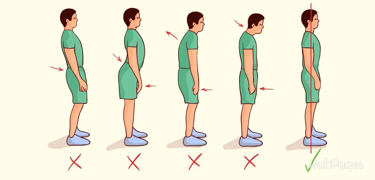 Почему не растешь в высоту. Осанка. Правильная осанка. Правильная и неправильная осанка. Правильная походка.