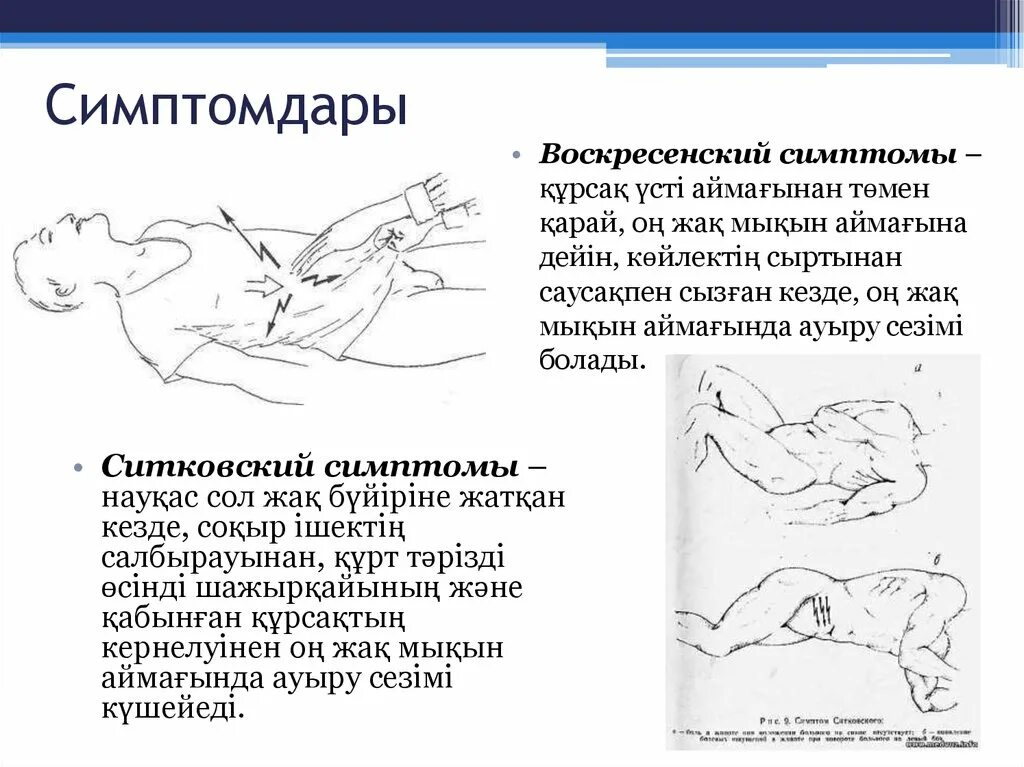 Положение при аппендиците. Симптом Воскресенского. Симптом Воскресенского при. Симптом Воскресенского рубашки.