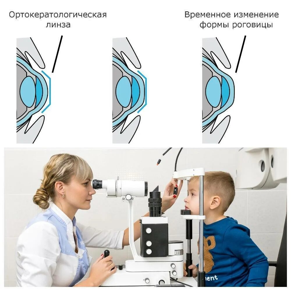 Линзы с какого возраста можно носить детям. Линзы для коррекции миопии у детей. Контактная коррекция зрения. Контактная коррекция зрения у детей. Ортокератологические линзы для детей.