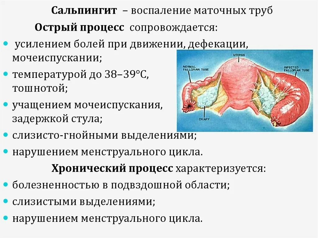 Чем грозит воспаление. Гонорейный сальпингоофорит. Хронический неспецифический сальпингит. Гонорейный сальпингит.