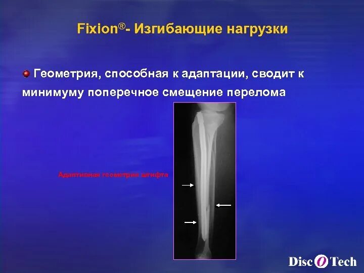 Поперечное смещение