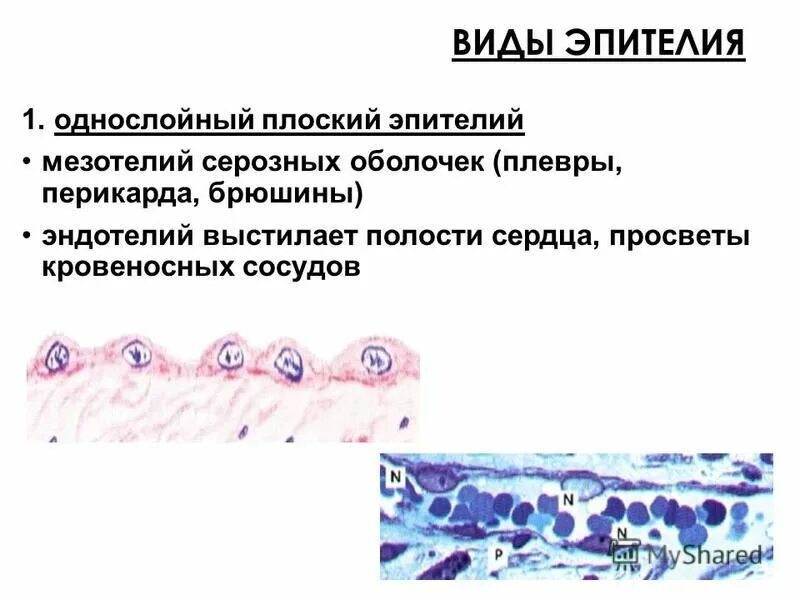 мезотелий сальника препарат. серозный эпителий. многослойный переходный эпителий препарат. эпителий околоушной железы. многослойный плоский неороговевающий эпителий роговицы глаза коровы.