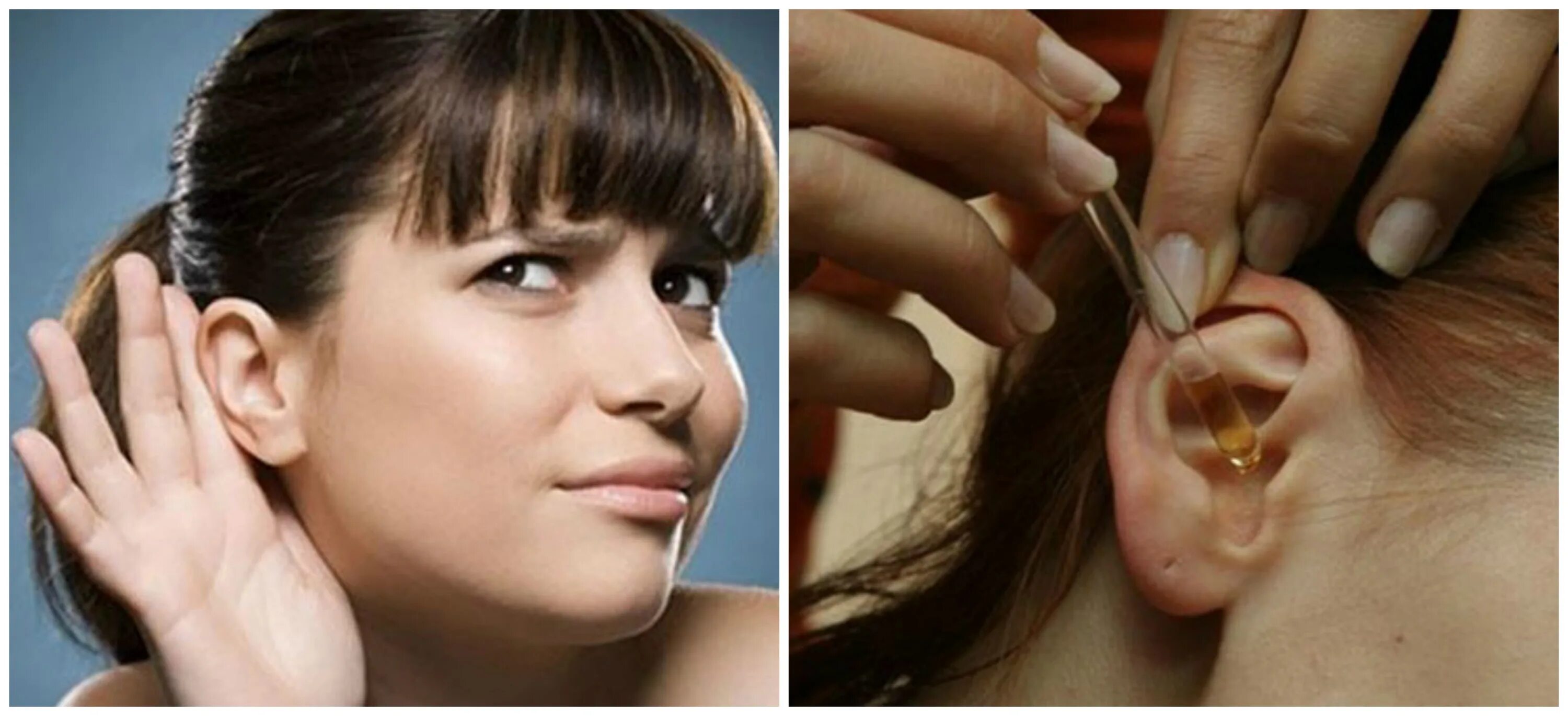 Как понять что пробка в ухе симптомы. Отомикоз серная пробка. Как понять что пробка в ухе симптомы. Наружный слуховой проход серная пробка. Как понять что пробка в ухе симптомы.