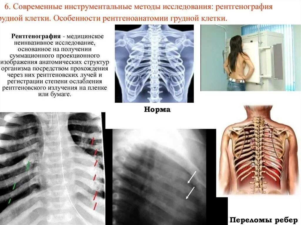 Рентген грудной клетки сколько раз можно делать. Инструментальные методы: 1) рентгеноскопия грудной клетки:. рентгенологическое обследование грудной клетки. методы обследования рентгенография грудной клетки. рентгенография грудной клетки инструментальный метод исследования.