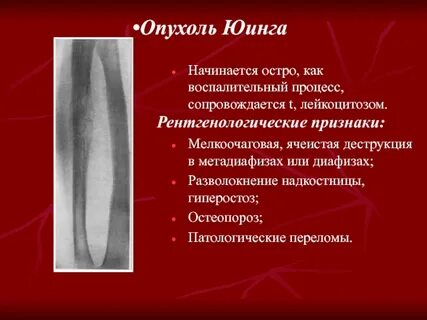 Воспаление перелома