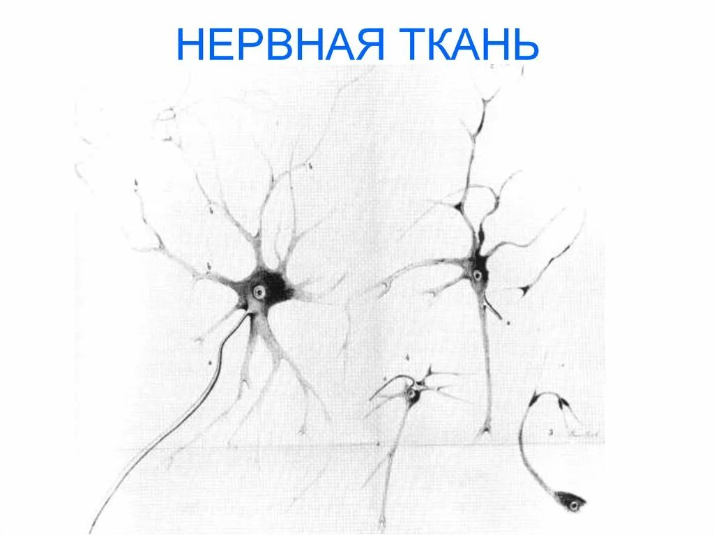 Вспомогательные нервные клетки. Нервная ткань микрофотография. Аксон нейрона микрофотография. Отдельные клетки нервной ткани. Нервная ткань зарисовка.